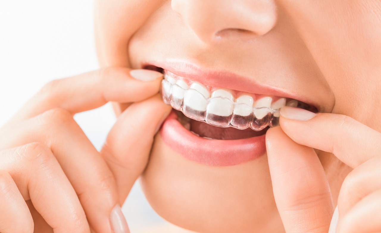 Franquia aposta na inovação e praticidade dos tratamentos odontológicos